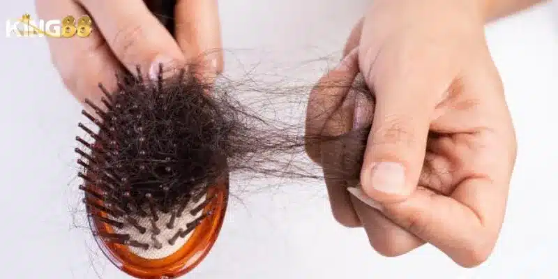 Mơ thấy rụng tóc – Giải mã giấc mơ và con số lô đề cực chuẩn 2 Mơ thấy rụng tóc là tín hiệu từ vũ trụ hay sự ngẫu nhiên?