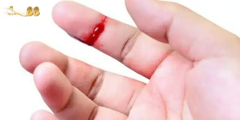 Nằm mơ thấy máu đỏ – Dự đoán chuẩn xác con lô đề hôm nay 4 Nằm mơ thấy máu đỏ đánh con số nào giúp bạn trúng lớn?