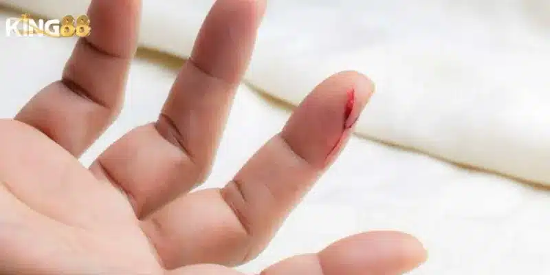 Nằm mơ thấy máu đỏ – Dự đoán chuẩn xác con lô đề hôm nay 3 Chia sẻ lời khuyên từ chuyên gia về nằm mơ thấy máu đỏ
